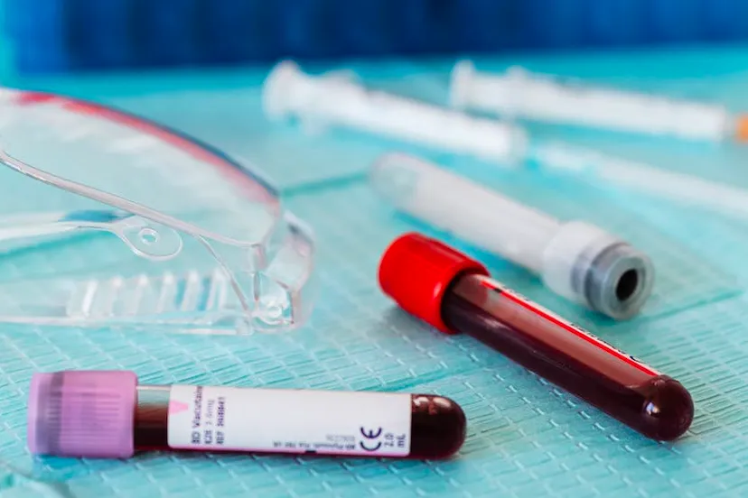 bloed voor bloedonderzoek