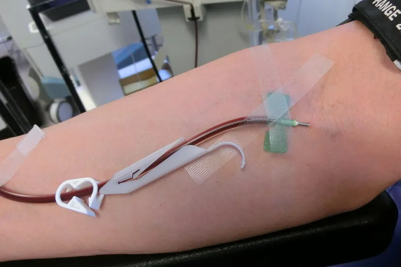 bloedafname ankawu cc by sa https creativecommonsorglicensesby sa30