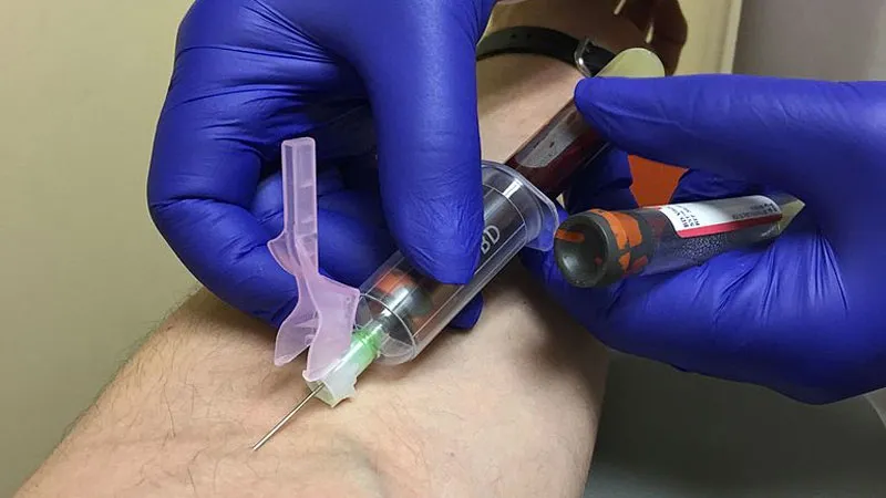 bloedafname voor onderzoek