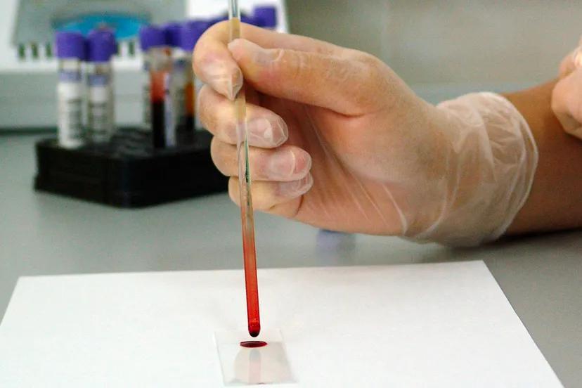 bloedtest cc0 via pixabay