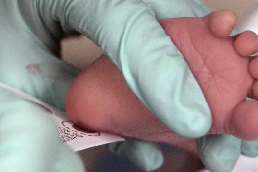 bloedtest via hielprik bij zuigeling