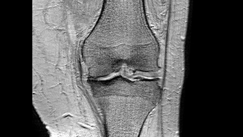 cc by sa 30 http creativecommonsorglicensesby sa30 artrose