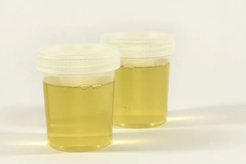 cc0 ewa urban via pixabay urine test