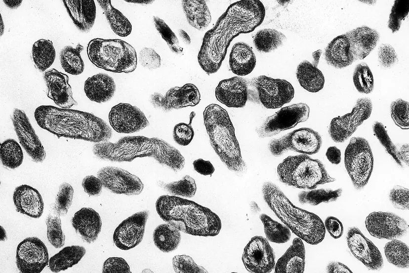 coxiella burnetii 01 q koorts