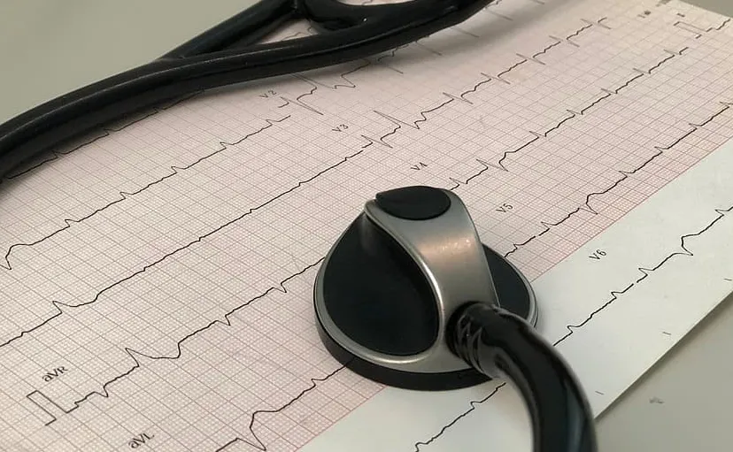ecg en stethoscoop