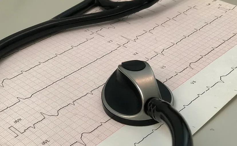 ecg en stethoscoop