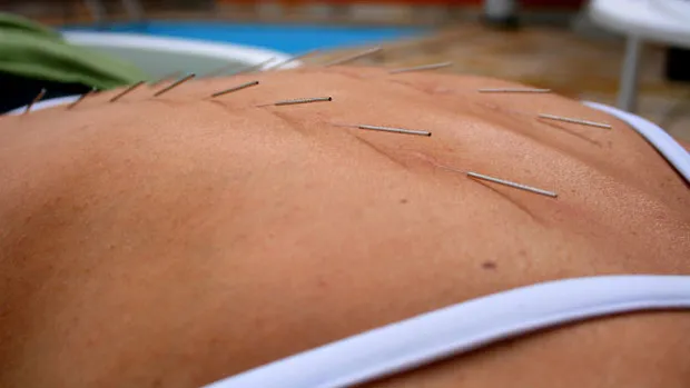 jb2b4gkpj709fg5j8o6ob8kkf acupunctuur ggiv cc by 2