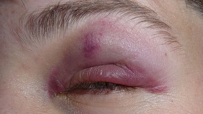 n3lrl55pjyrfos34z8bu52uy8 blauw oog