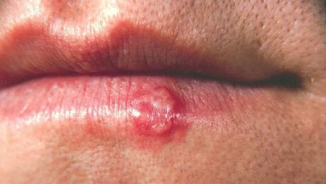 om5z4c70ry5g79j9kbbo6pp1k koortslip