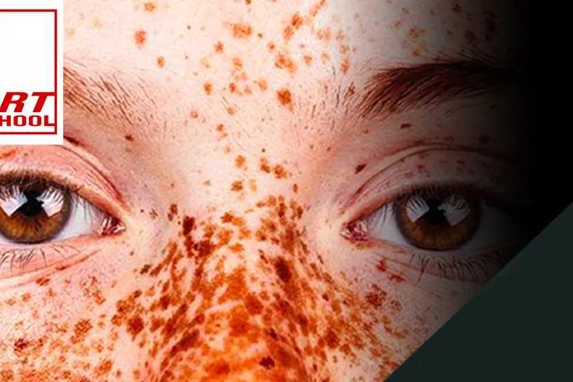 pitboel art school sproeten