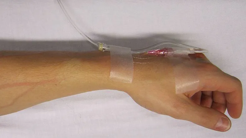 spoec1r2semz11nrxfqvf1rrd hq arm ziekenhuis morfine pomp