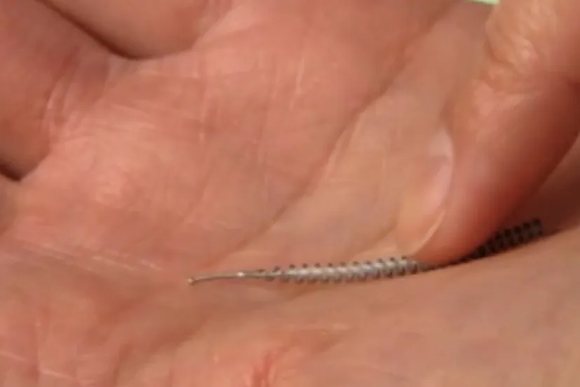 still uit what are essure and adiana tubal occlusions