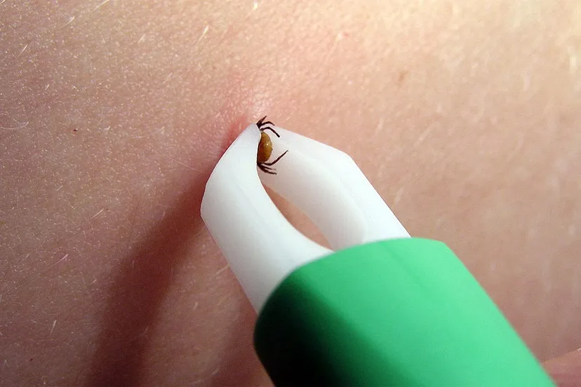 teek verwijderen met tekenpincet evanherk cc by sa 30 via wikimedia commons