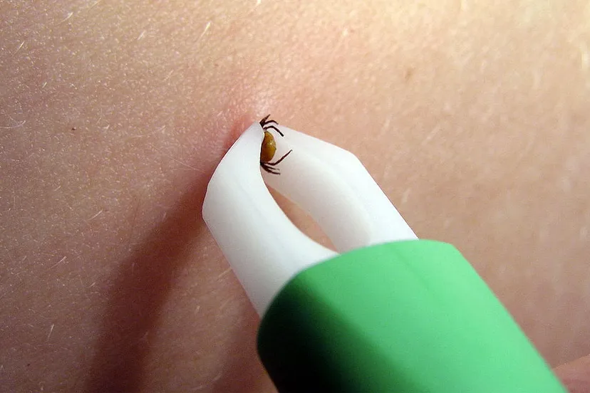 tekenbeet en tekenpincet