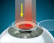 v9mmf42ixyo1svpaol50trnah 200194