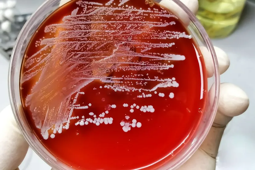 staphylococcus petrischaaltje