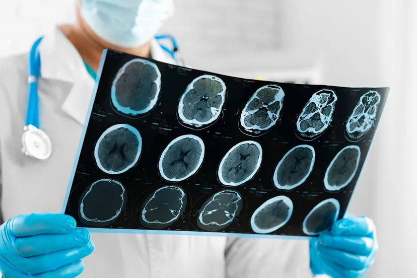 arts uitslag mri scan