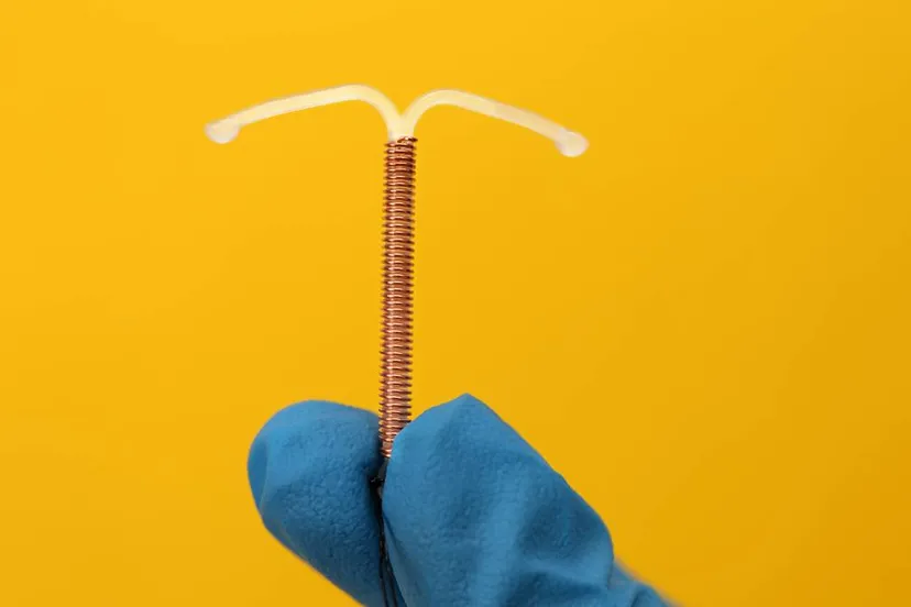 koperspiraaltje iud