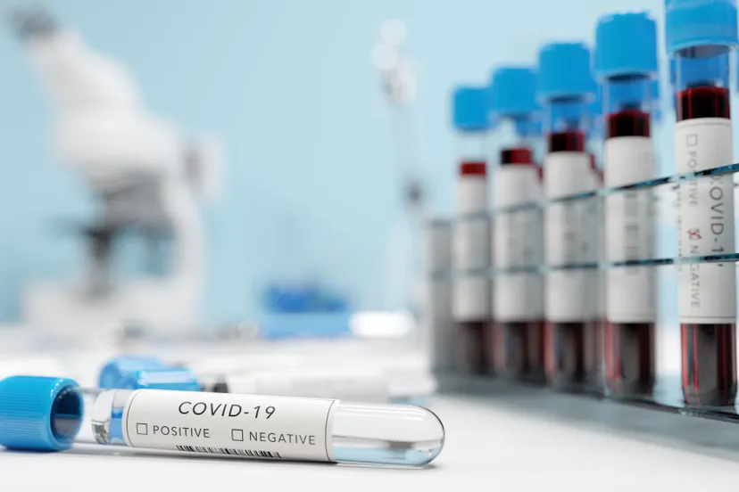 testing for coronavirus covid 19 in a lab covid me vywhu6x 50