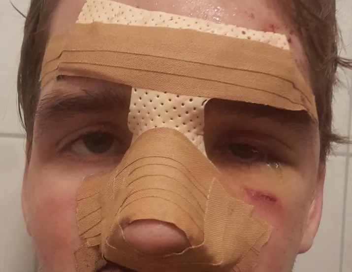 mishandeling jongen tilburg 715