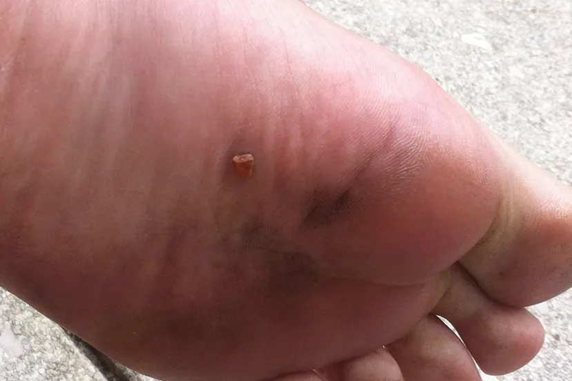 igeo40n5ao6zz1fgxl3i6u2rb img3260 e1392817829993