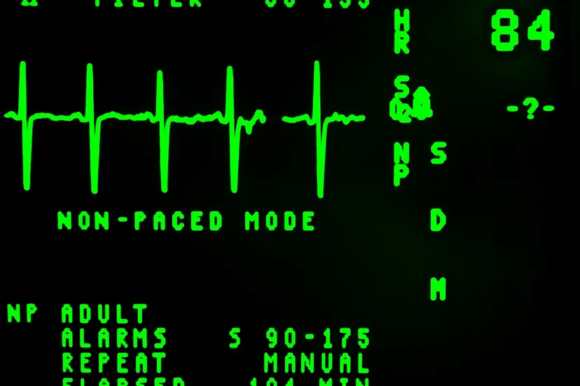 electrocardiogram 16948 1280