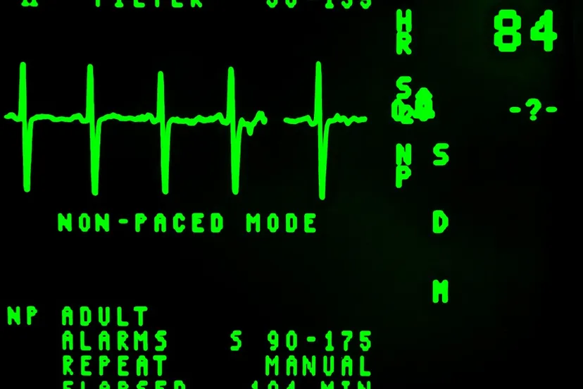 electrocardiogram 16948 960 720