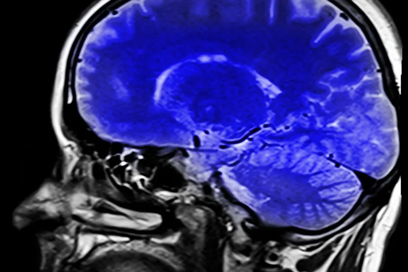 head ga3463e7eb 1280