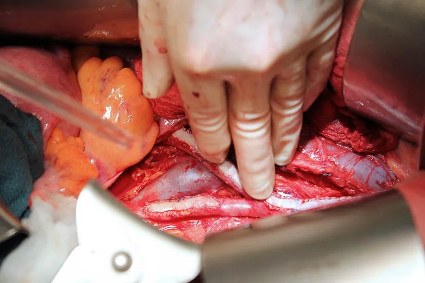 vascular surgery 1049536 1280 2