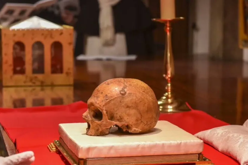 schedelthomasvanaquino