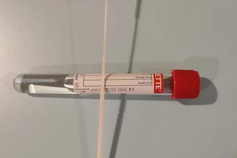 corona regis obydol via pixabay