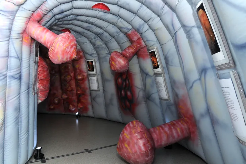 opblaasbare dikke darm01