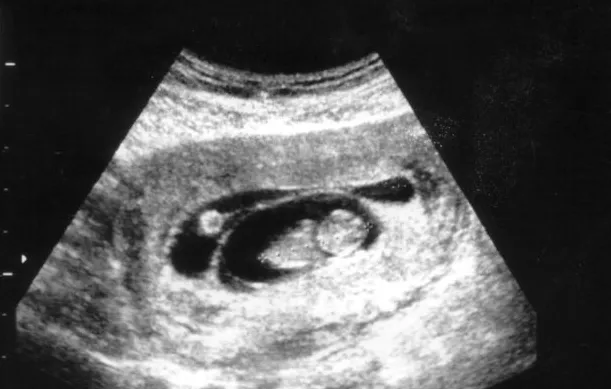 screenshot 20200511 114117