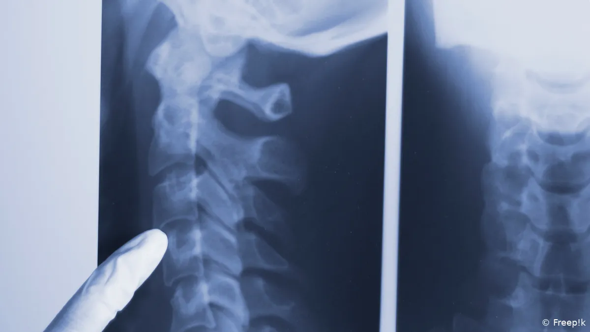 Chiropractoren zonder vergunning met röntgen in de weer