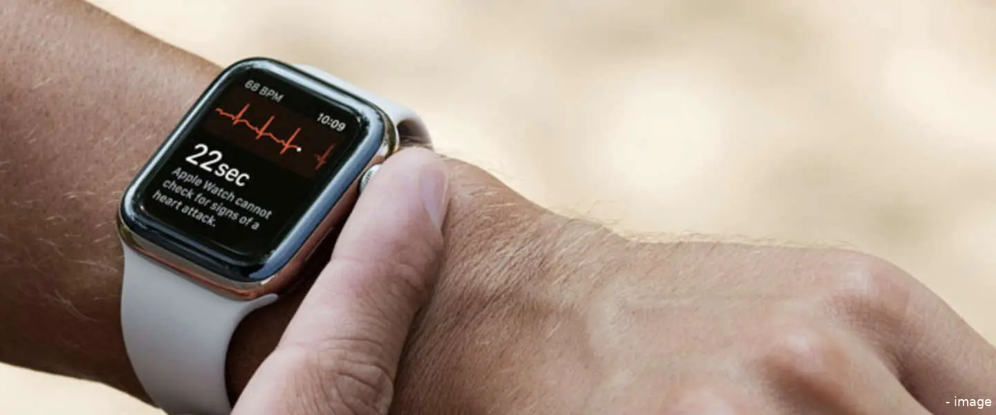 apple watch series4 ecg