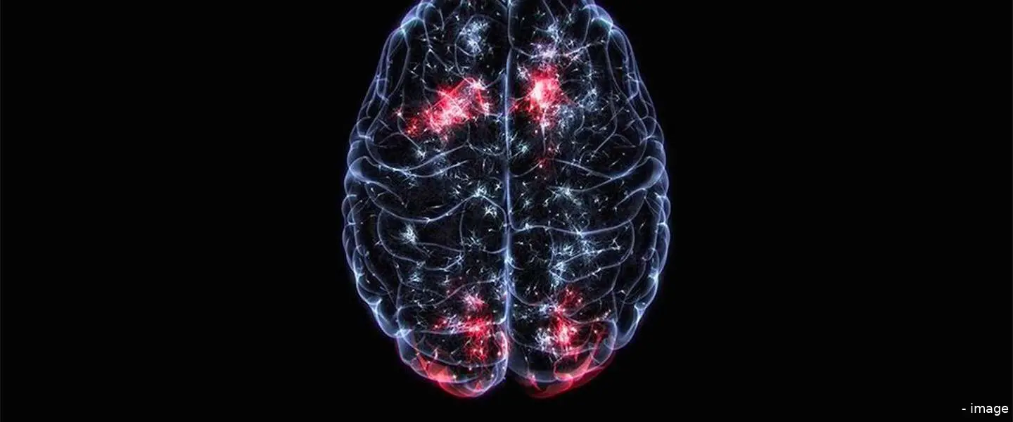 porsche dopamine