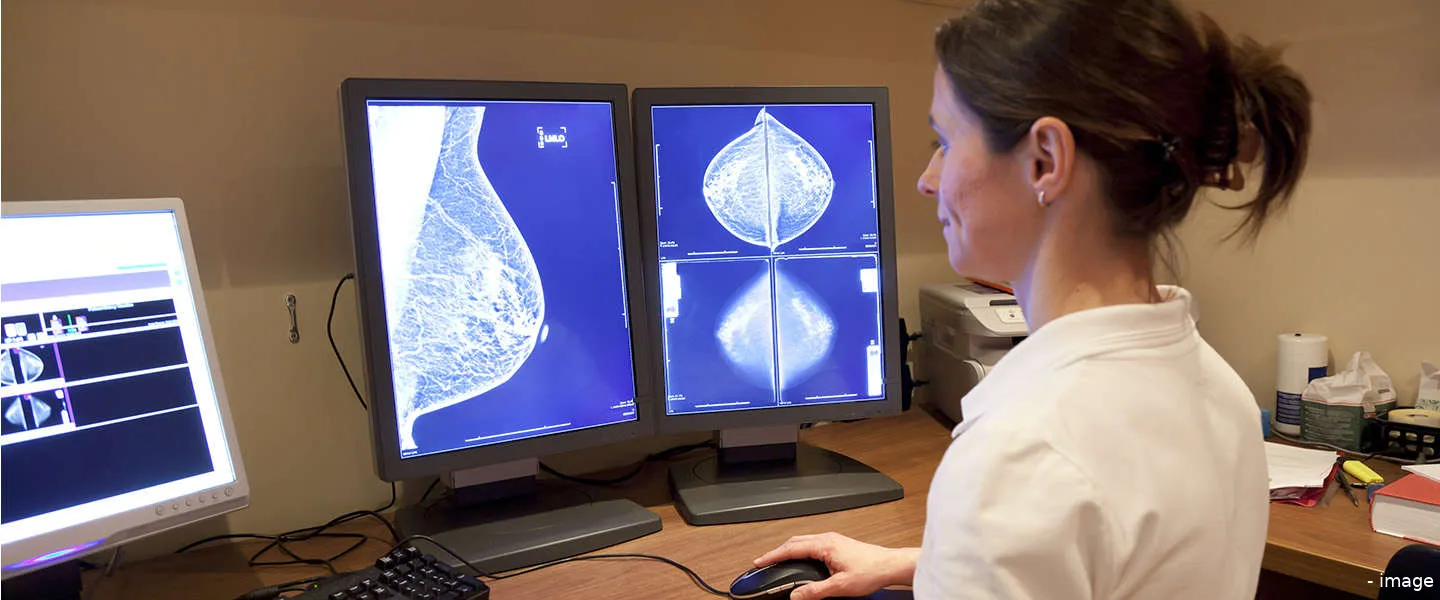 ai google borstkanker