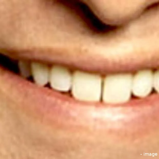 bobby kotick wordt rijker en dat is jouw