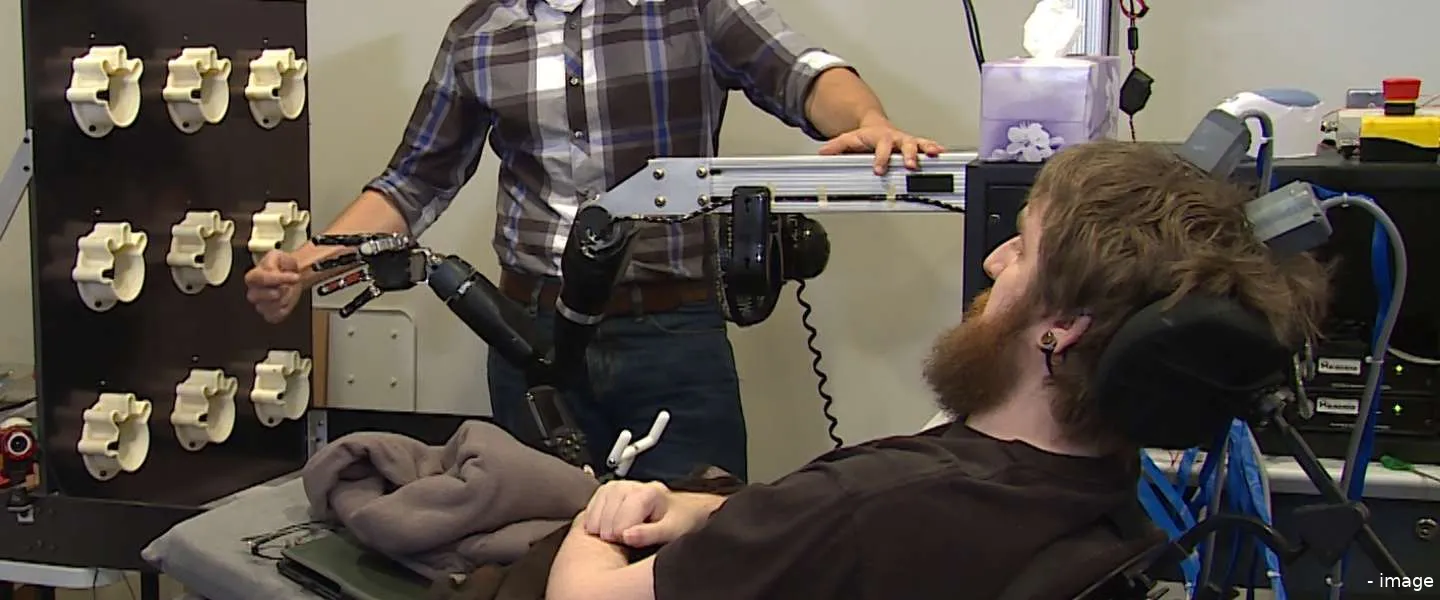 robotarm breinchips voelen