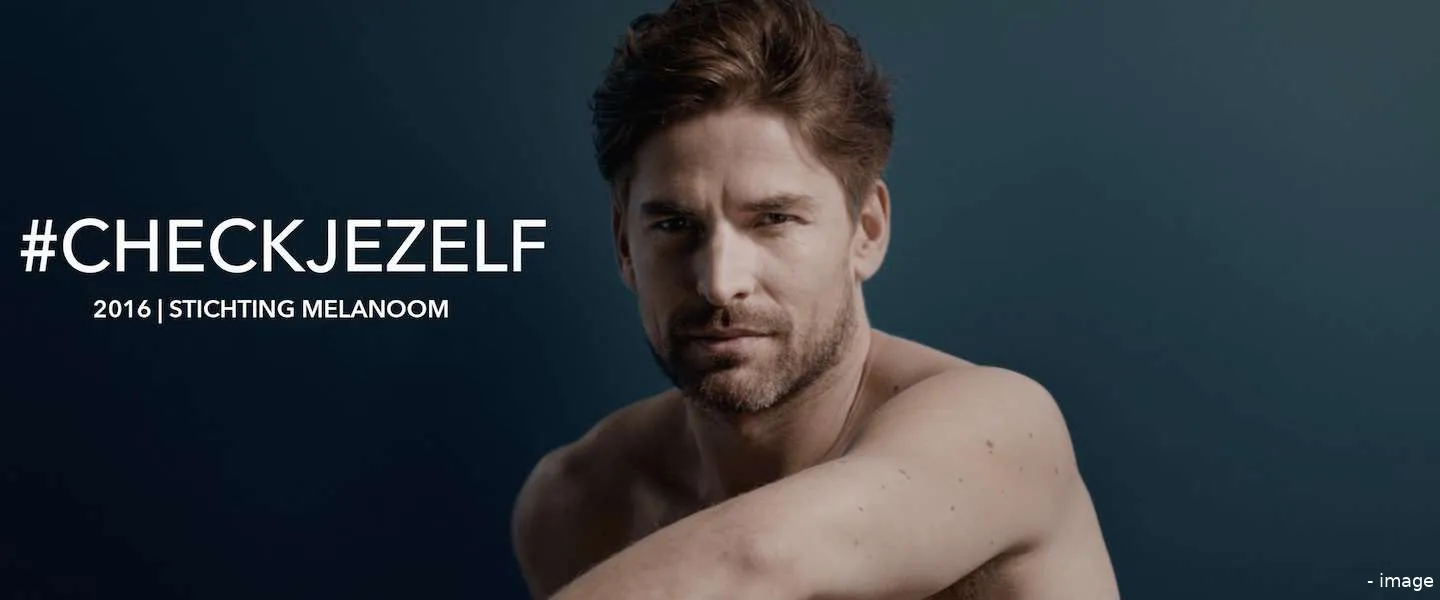 stichting melanoom checkjezelf