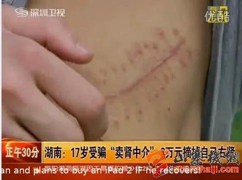 chinese student sells kidney for ipad 2