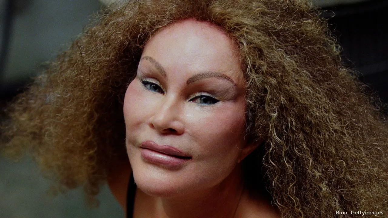 jocelyn wildenstein