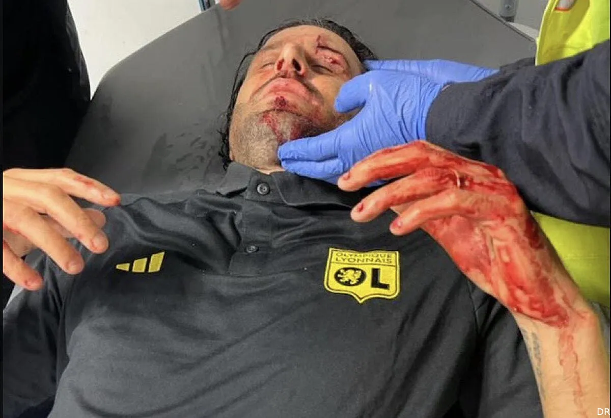 om ol aucune sanction marseille peut dormir tranquille grosso 367309