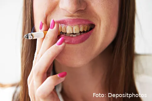 Depositphotos_26246893_XL