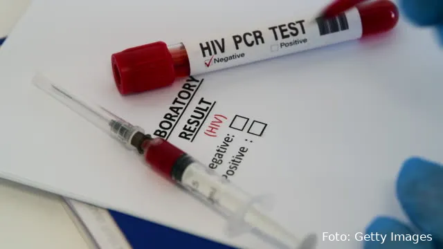 hiv foto