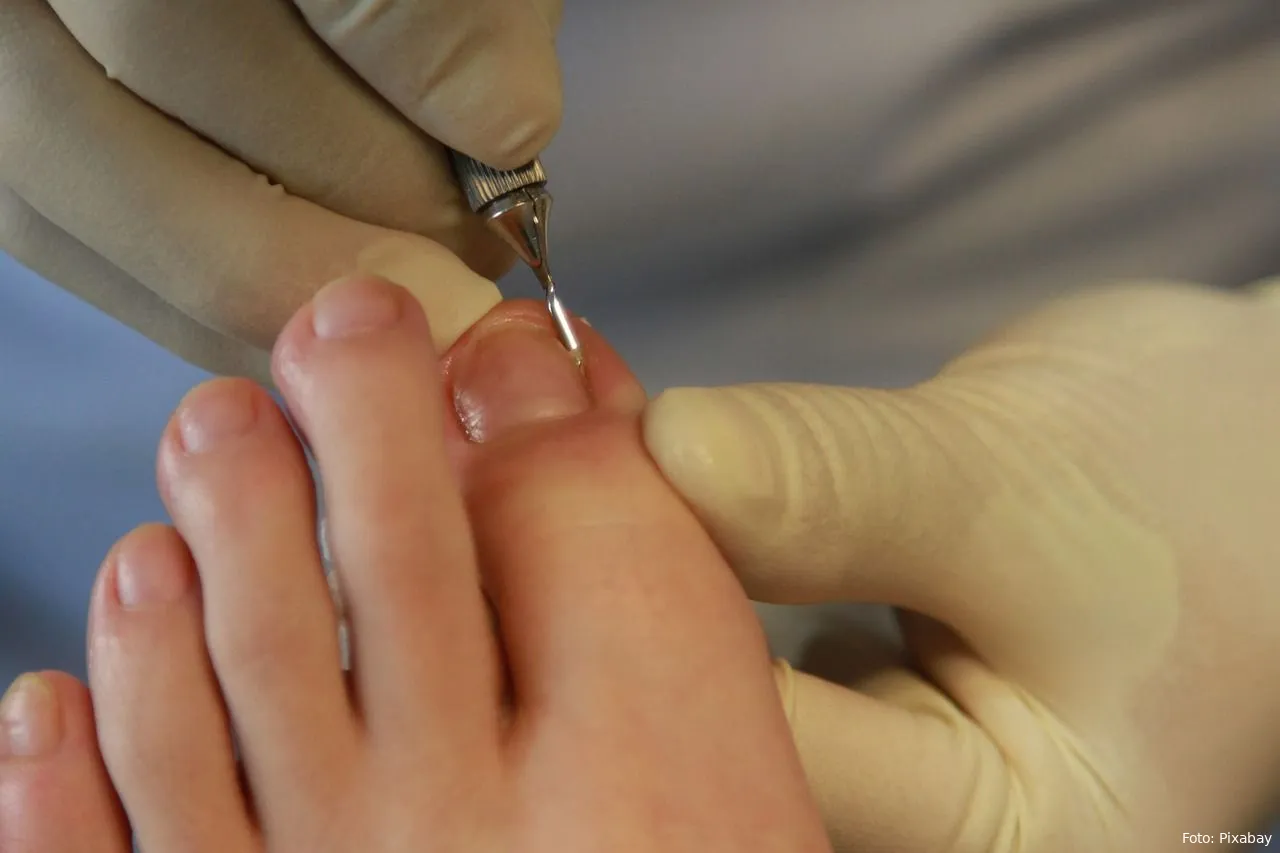 teennagels verzorging gezondheid