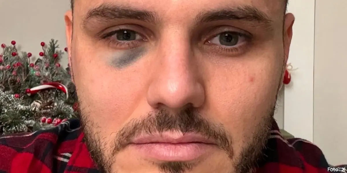 icardi oeje