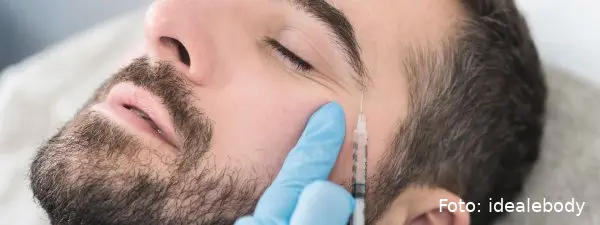 fillers voor mannen