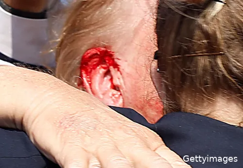 Photo by Anna Moneymaker/Getty Images