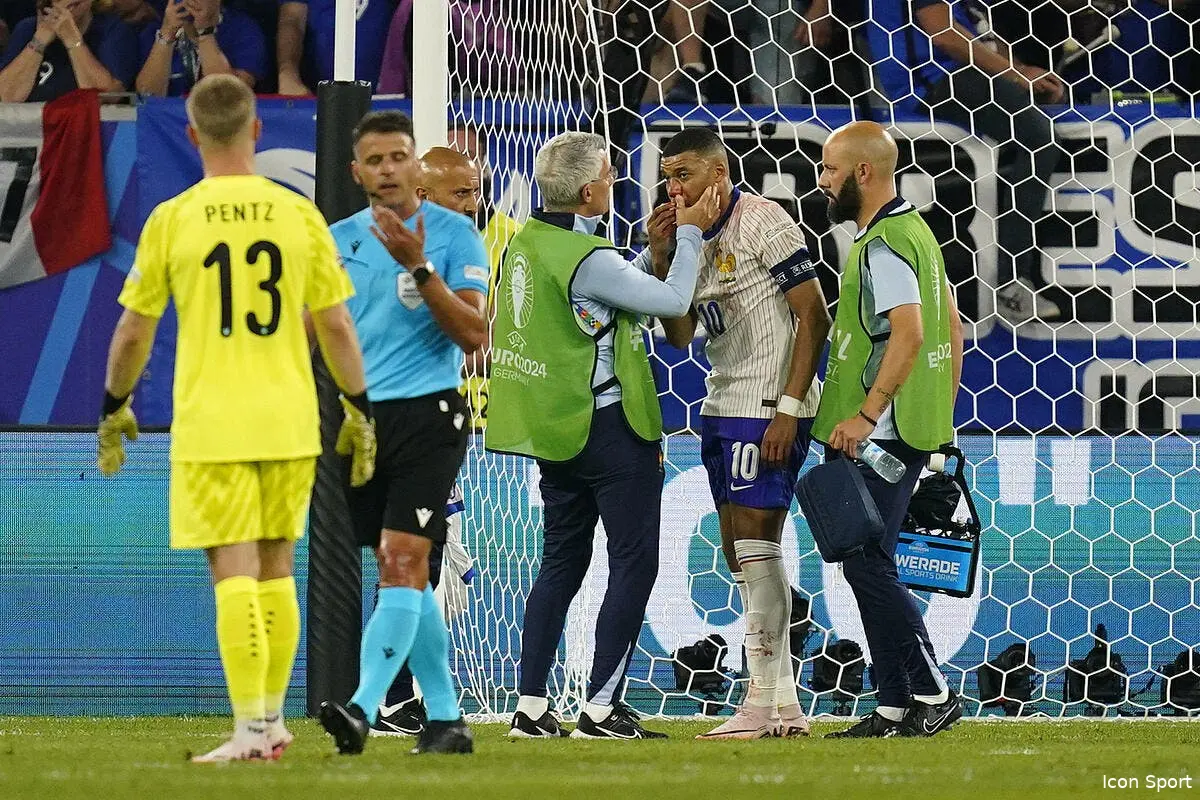 EdF : Kylian Mbappé se fait casser le nez et chambre